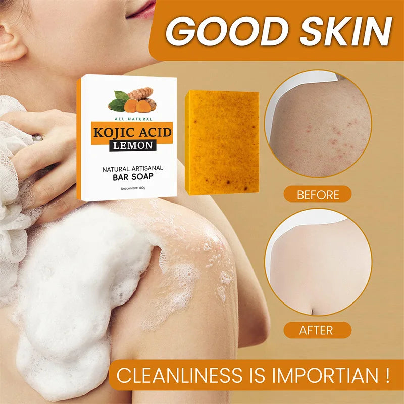 Turmeric Granular Soap Lemon Soap Kojic Acid Soap Ginger Bath Cleansing Soap Body Whitening Body Care Oil Removal Handmade Soap